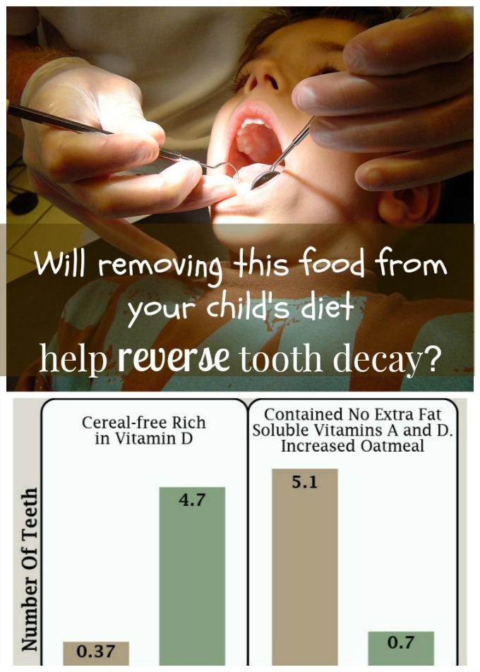 Grain free diet and tooth decay ITT